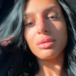 doživela saobraćajnu nesreću