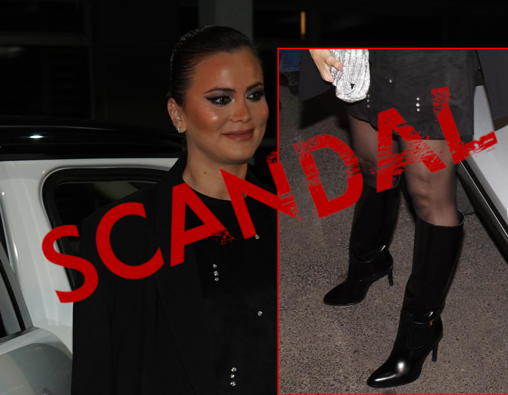 Spojene butine i celulit Foto Hype tv