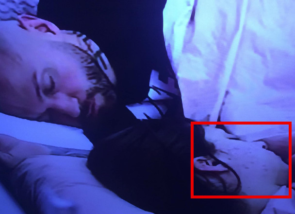 FUJ! MIONINO LICE UNAKAŽENO? Foto:Youtube printscreen