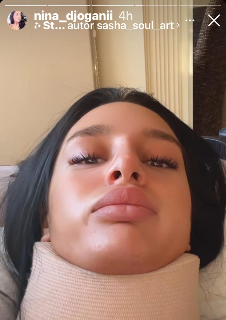 doživela saobraćajnu nesreću