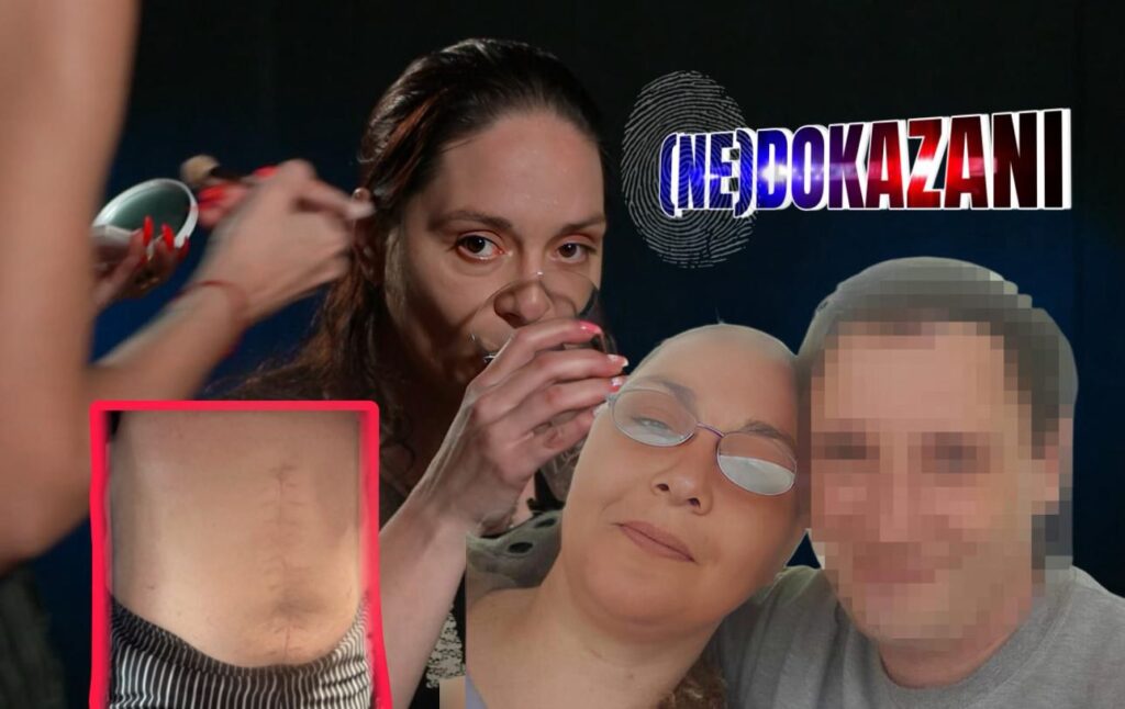 (NE)DOKAZANI: "UDARAO ME JE ČEKIĆEM U GLAVU, SVE DOK ČEKIĆ NIJE PUKAO!" Uznemirujuća ispovest žene koju je pre MANJE OD MESEC DANA bivši partner napao nožem u njenom stanu na Čukarici Dragana Krunić Nedokazani Foto:Hypetv/privatna arhiva
(NE)DOKAZANI: