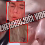 Lipti niz lice Jovana Tomić Matora foto:x:istinamijeime