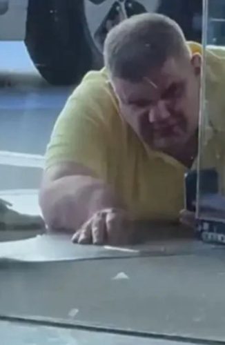 UZNEMIRUJUĆE NECENZURISANE SLIKE: Evo kako je izgledala IZDEFORMISANA SMRSKANA RUKA Saše Mirkovića nakon pokušaja ubistva I MUČKOG ŠUTIRANJA ispred hotela u Zagrebu