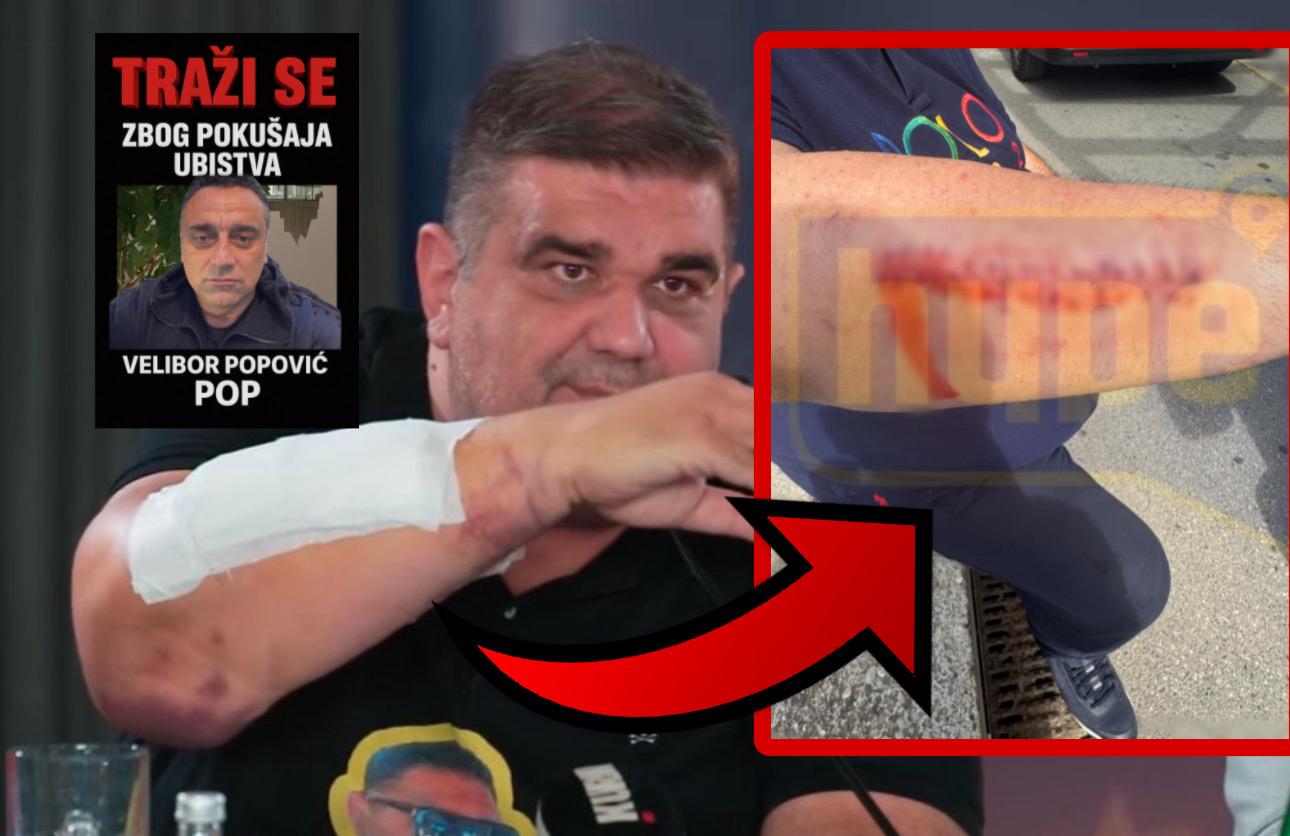 UZNEMIRUJUĆE FOTOGRAFIJE IZMASAKRIRANE RUKE SAŠE MIRKOVIĆA