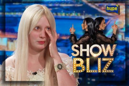 "POJAVIO MI SE KANCER ISPOD OKA" Sumi otkrila da zbog albinizma NE SME NA SUNCE: Evo šta se dešava ako se ODMAH ne skloni u HLAD